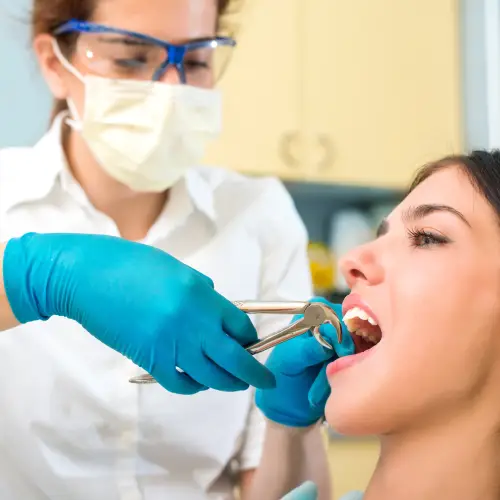 Dentist in gloves and safety glasses using forceps on a patient's tooth