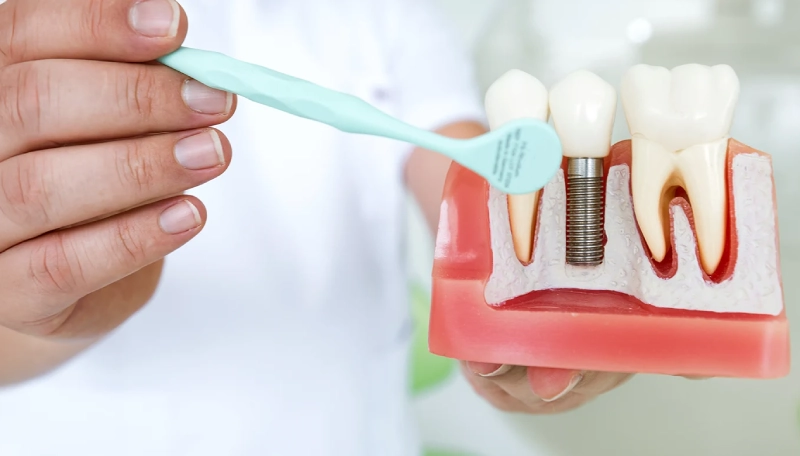 Do Dental Implants Hurt?