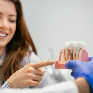 How-Dental-Implants-Work_-A-Quick-Overviewocedure