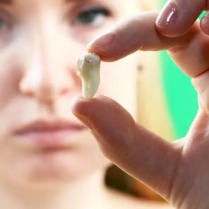 What-Happens-Before-a-Tooth-Extraction