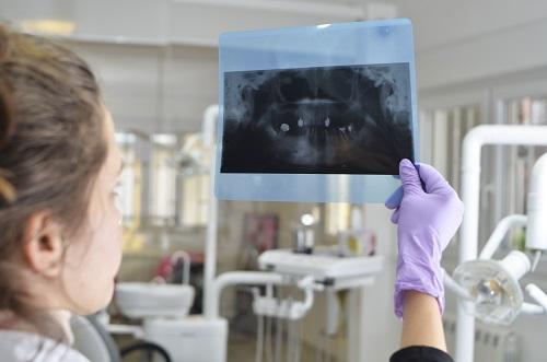 Dentist in Towson MD looking at dental x-ray scans