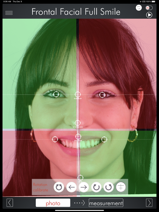 Patient getting digital smile design services at dentist in Towson MD