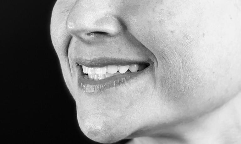 Patients smile after procedure for dental crowns and veneers in Towson MD