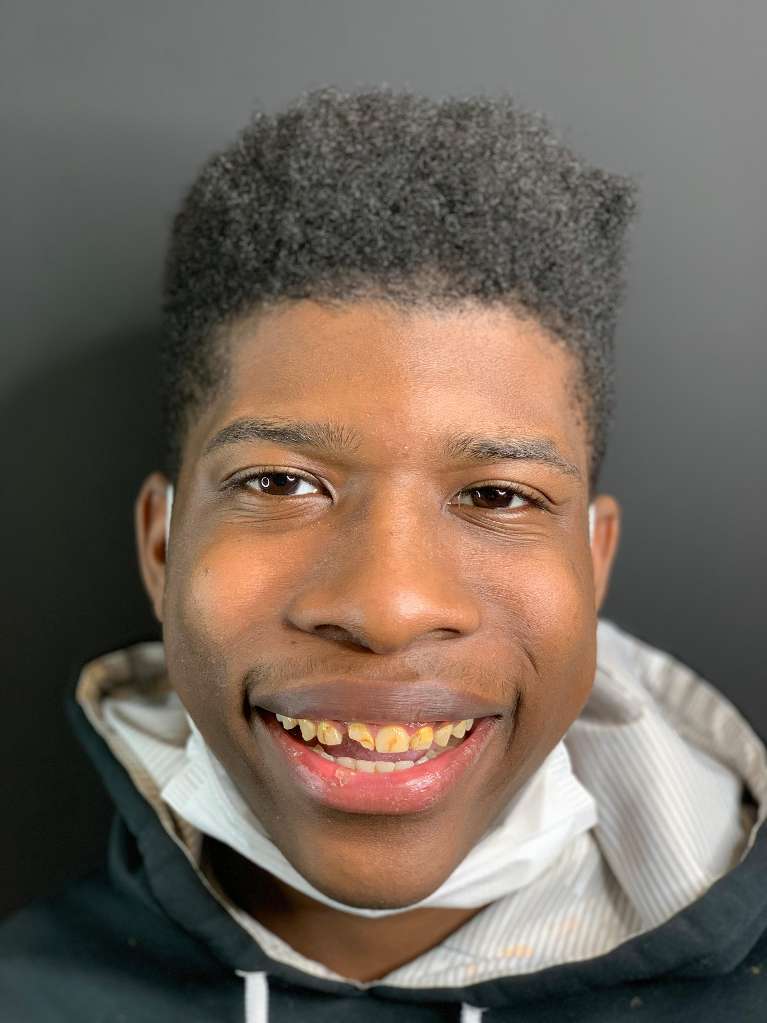 Patient with chipped tooth smiling at cosmetic dentist in Towson, MD